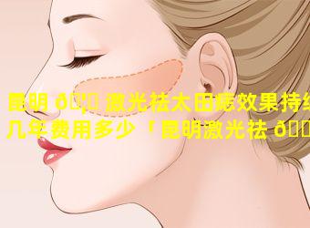 昆明 🦆 激光祛太田痣效果持续几年费用多少「昆明激光祛 🌿 痣最好的医院」